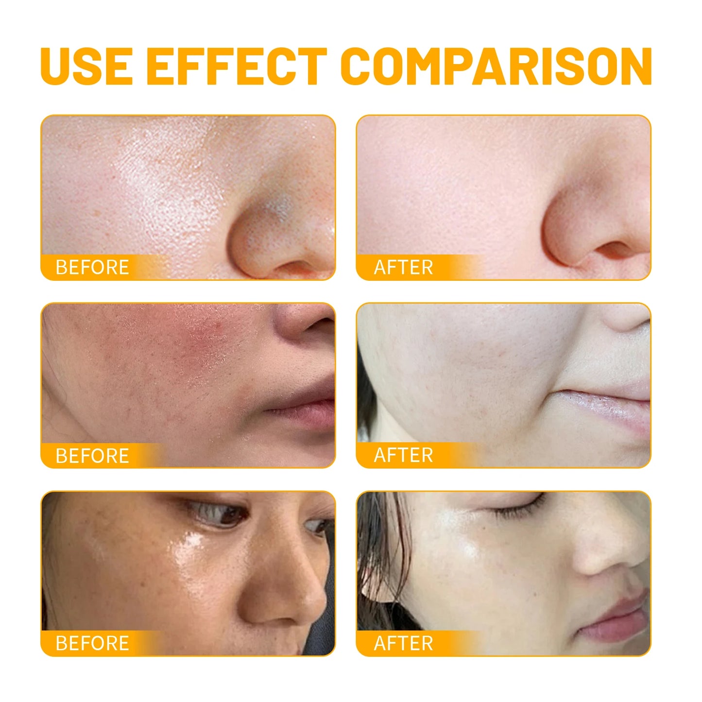Turmeric facial skincare set