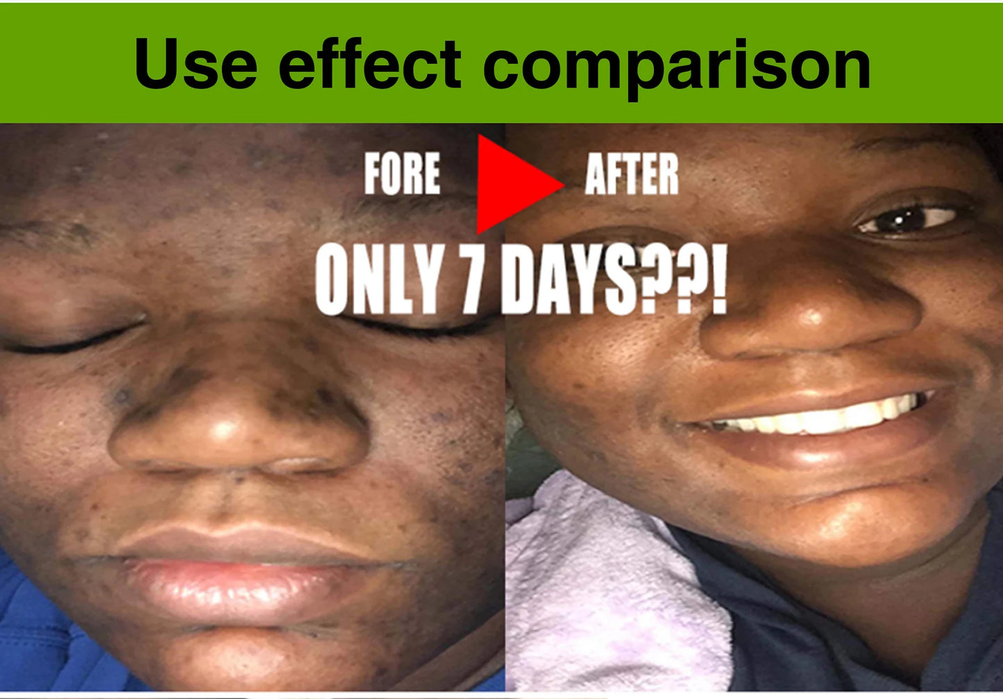 Cool Fresh Aloe Soap Bar, Reduce Acne and Black Spots, Clean Skin, Oil Control, Exfoliation, For Face And Body Use
