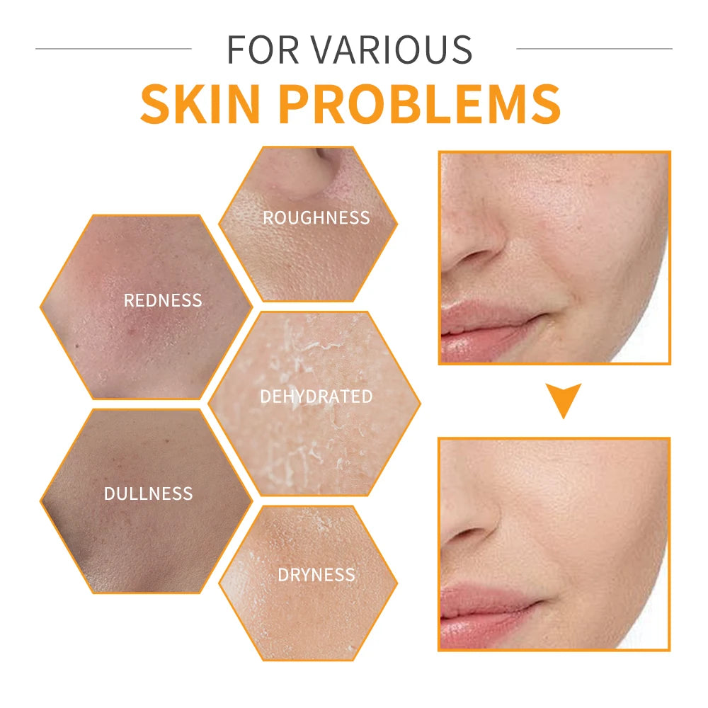 6pcs/set Vitamin C Skin Care Set  Face Cream Moisturizing Anti Wrinkles Face Care Kit Gift Box