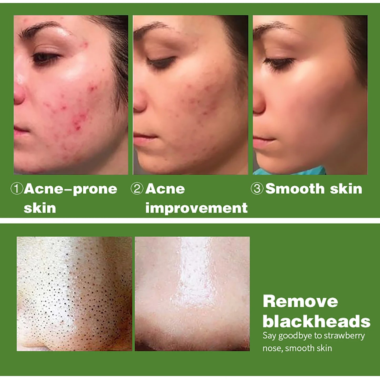 Cool Fresh Aloe Soap Bar, Reduce Acne and Black Spots, Clean Skin, Oil Control, Exfoliation, For Face And Body Use