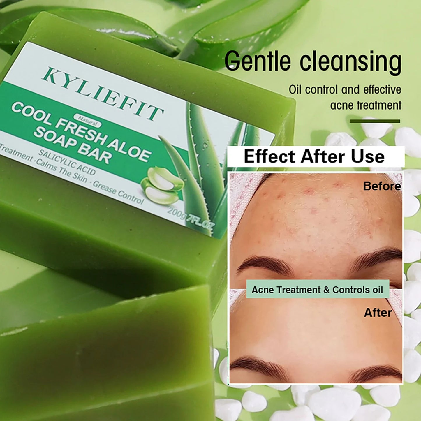 Natural Moisturizing Bath Soap,  Skin Lighten, Vegan, Handmade with Aloe Vera, Remove Acne, Pimples